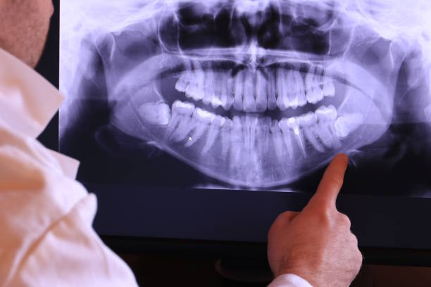Best Dentist for Tooth Abscess  in Nescopeck, PA