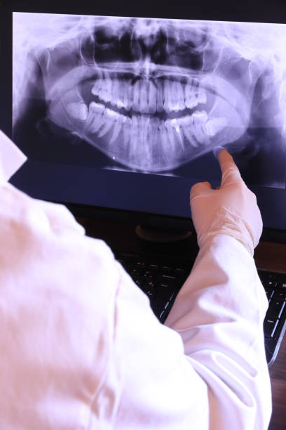 Best Tooth Infection Emergency Dentist  in Nescopeck, PA