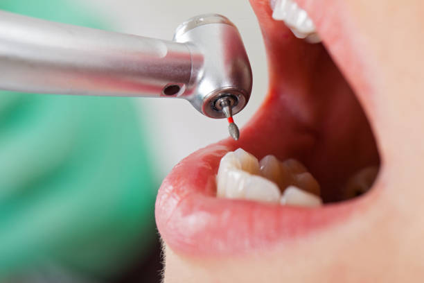 Best Tooth Infection Emergency Dentist  in Nescopeck, PA